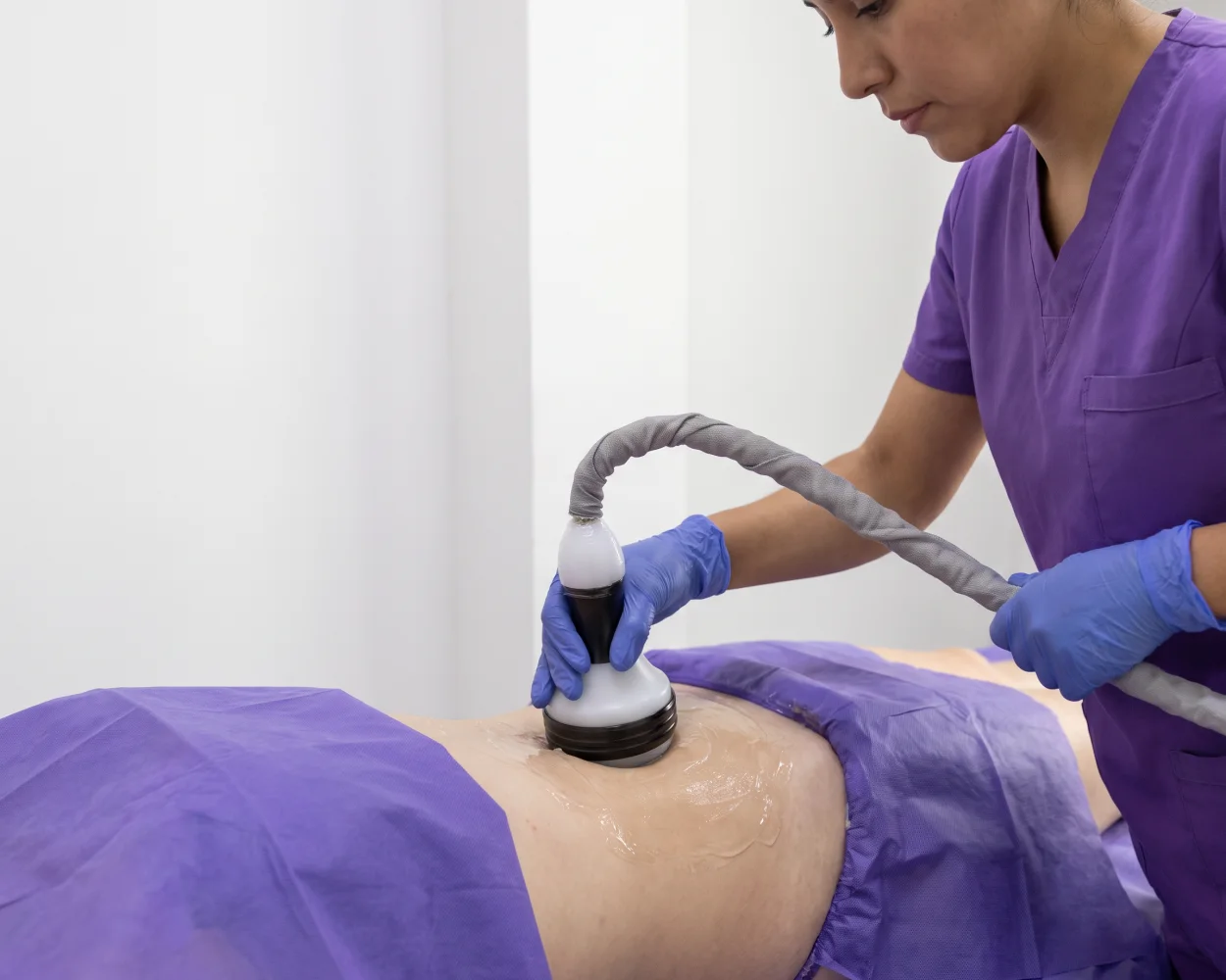 Aplicación de lipólisis progresiva sobre el abdomen