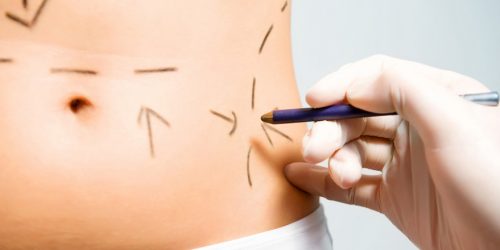 Tratamientos estéticos: un mundo de posibilidades para tu cuerpo