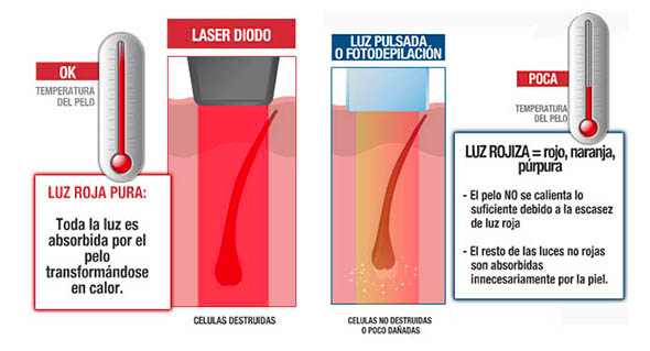 soprano-vs-diodo